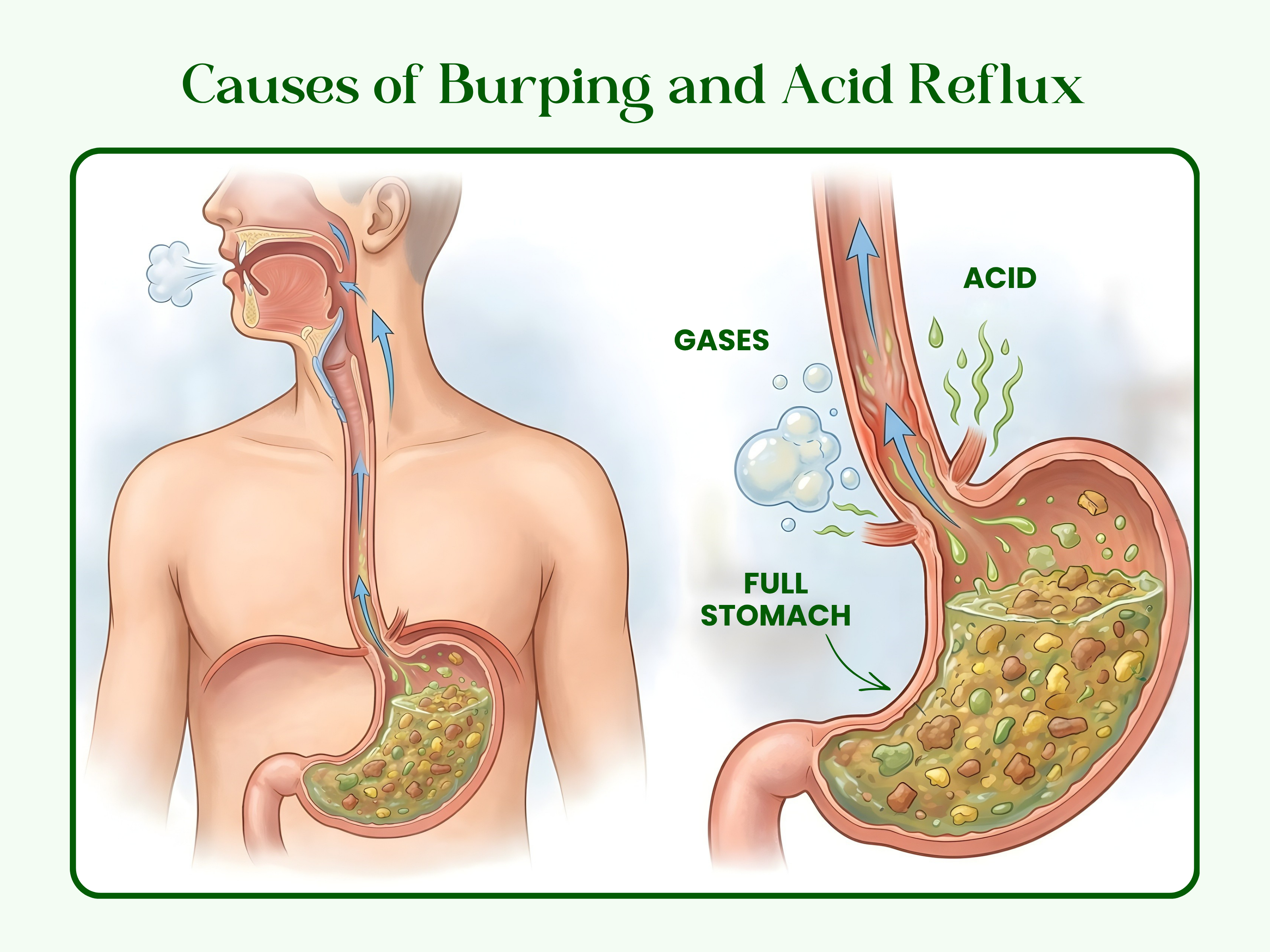 Delayed gastric emptying mechanism